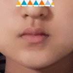 <b>입술</b>성형 하는게 낫겠지?