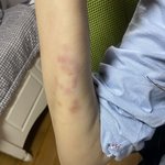 <b>베라</b> 알바하면 팔이 이렇게 됨