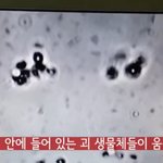 [댓글부탁해] 큰일났음 백신에서 괴생물체  나옴