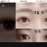 쌍꺼풀 이거 다 무슨라인임?