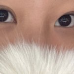 쌍수 1달<b>반째</b>야 어때?