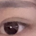 <b>쌍수티</b> 많이나..?