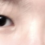 쌍수 진짜 할까 걍
