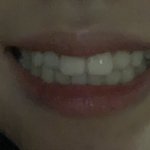 교정 해야함??