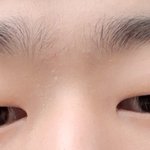 [댓글부탁해] <b>본인</b>... 남자 쌍수 후기 <b>사진</b>有