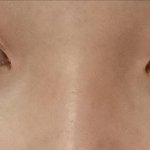 [드루와] 코 성형 하는게 나을거 같아???