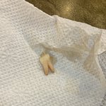 성신<b>여대</b> 순대국 먹다가 이빨 나옴