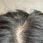 [댓글부탁해] 2주만에 <b>정수리</b> 채워진거 신기하지않음?