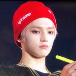 [이태용] 진챠미안한데 얘 너무 볼이 말랑해<b>버임</b>