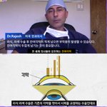 [이것좀봐줘] 사람들이 의외로 모르는 라식<b>라섹</b> 안전기준.jpg