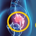 <b>롤러</b>타다가