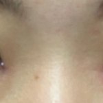 [댓글부탁해] 쌍수 21차인데 좀 봐<b>주랑</b> ㅠㅠ