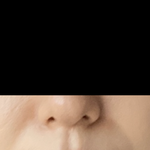 [댓글부탁해] 팔자주름 <b>필러</b> 맞은 전후 어때???