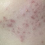 피부 이 1ㅈ ㅣ 1<b>랄</b> 남