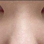 <b>복코교정</b> 전후 레전드