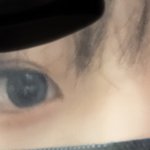 나 <b>짝눈</b> 쌍수해야될거같지?