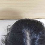 혐주의) 나 <b>탈모</b> 맞는거같아?