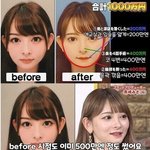 성형에 1억 6000만원 썼다는 얼굴 ㄷㄷ