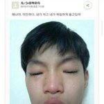 금수저 조카 <b>배아픔</b>