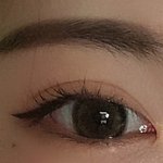 <b>쌍수</b>붓기