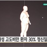정신질환 <b>유형</b>