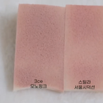 콧볼축소 <b>비포</b>에프터 볼사람