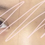 [댓글부탁해] 나 <b>매몰</b>쌍수2일찬데 일주일안에 붓기 거의다 빠질수있을까...