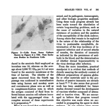 마스크를 꼭 써야 한다는 년놈들 잘 봐라