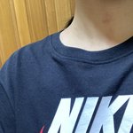 [드루와] 이거 혹시 키스마크 같음?