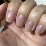 [드루와] 나 <b>손톱</b> 왜케 파랗냐