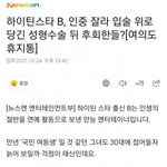 [댓글부탁해] 모 <b>여가수</b> 입술성형 후회중