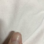 [댓글부탁해] <b>손톱</b> 뜯었는데 ㅈ됨