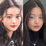 근데 쌍수를 했는데 눈이 작아질수가 있음??