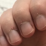 <b>거스러미</b> ㅈㄴ 일어남