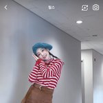 아니 <b>태연</b> 피부 왜 이래