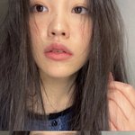 피부이거어케없애