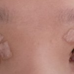 [댓글부탁해] 쌍수 4일차 어때