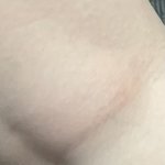 [댓글부탁해] 너네 무릎 <b>뒤쪽</b>도 이래???