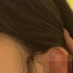 클럽서 여성 ‘귀 절단’ <b>테러</b>... “나도 모르게 피가 주르륵”