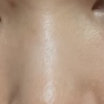 이렇게 코수술 할려면 어케 해야됨?