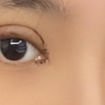 쌍수 붓기 어때