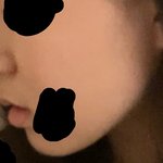 [19] 사진ㅇ)이런코는 뭐해야함??