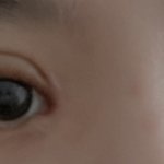 오늘 <b>실밥</b> 풀었는데 ㅇㄸ..