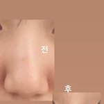 [댓글부탁해] 코쉐딩 <b>전후</b> 차이 어때ㅠㅠ