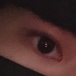 [댓글부탁해] 쌍수 2개월차 사진 흐림 <b>양해</b> 부탁0--0   괜찮은가..?
