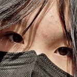 저 몽고<b>주름</b> 심한가요?