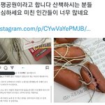누가 <b>악의</b>적으로 공원에 소세지 뿌리고 다닌다함