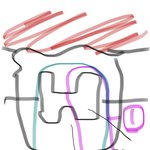 교정기 고무줄 껴본애들아