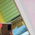 내 <b>무턱</b>보고갈사람^_____^