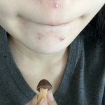 내 피부 보셈zzzzzzzz